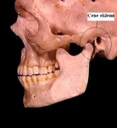 ÇENE EKLEMİ  ÇENE EKLEMİ AĞRISI